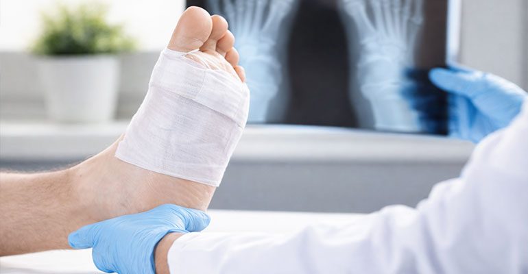 Foot & Ankle Surgery Panvel – Ankle Fracture & Ligament Treatment near Panvel Station