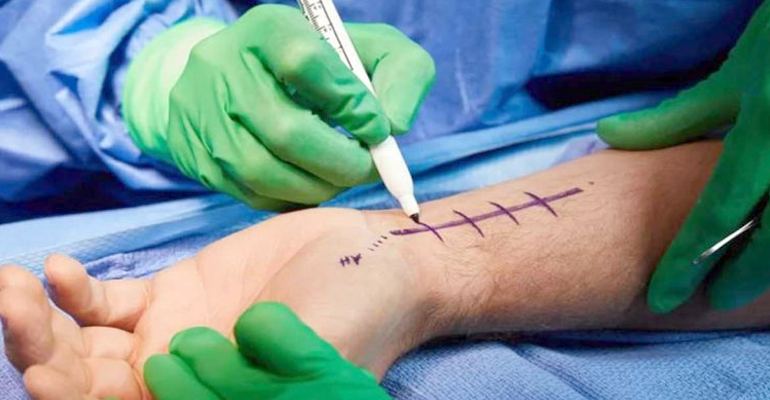 Hand Surgery Panvel – Fracture, Tendon & Nerve Injury Treatment, Navi Mumbai