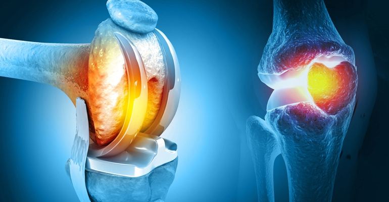 Hip Replacement Specialist Panvel – Best Robotic Joint Replacement Hospital Navi Mumbai