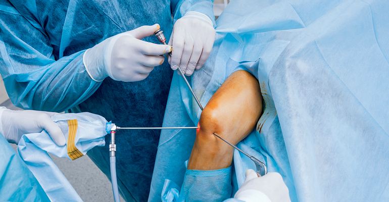 ACL Ligament Tear Surgery Panvel – Arthroscopic Surgery Hospital Raigad, Mhatre Accident Hospital