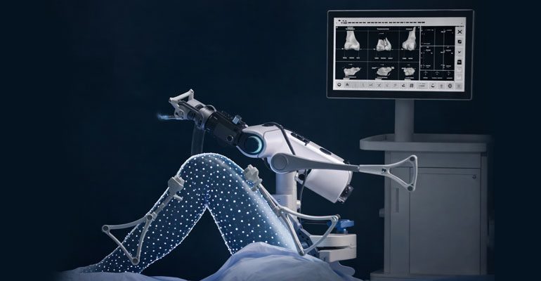 Robotic Knee Replacement Surgery Navi Mumbai – रोबोटिक गुडघा बदली शस्त्रक्रिया, Mhatre Accident Hospital