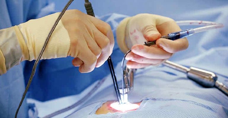 Minimally Invasive Spine Surgery Navi Mumbai – मणक्याचे डॉक्टर पनवेल, Mhatre Accident Hospital